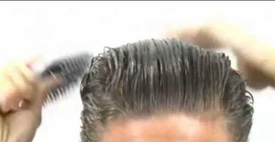 Cuando se observa los resultados de un trasplante de pelo?