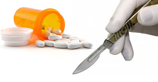 Opciones de trasplante capilar: Medicación vs. Cirugía